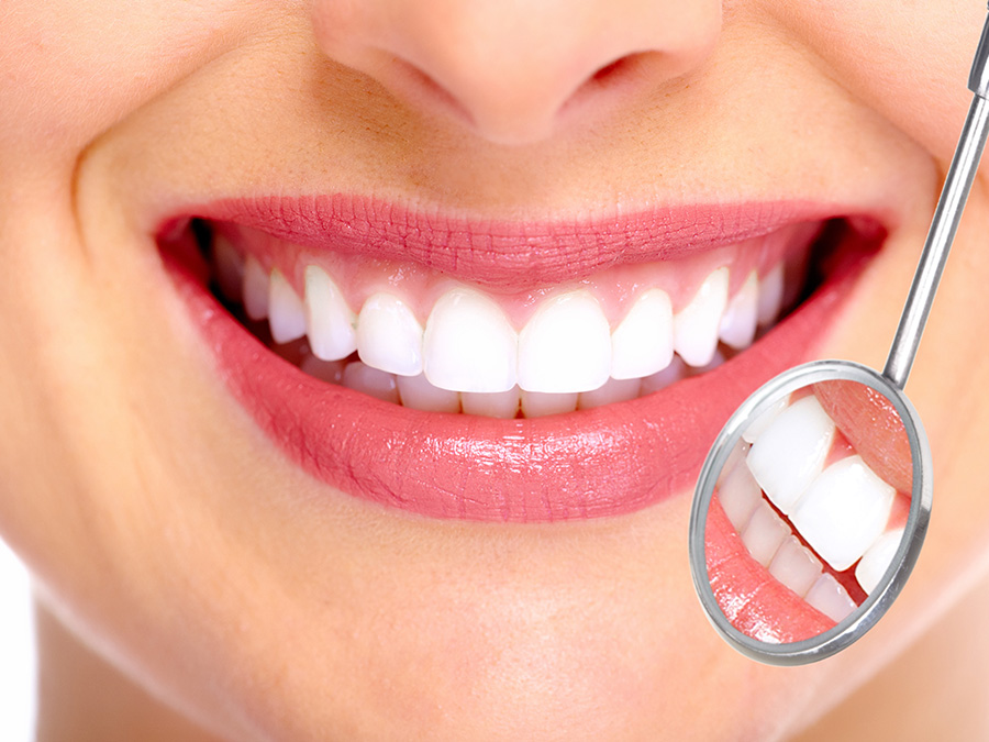 フッ素塗布 虫歯予防